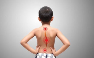 Искривление позвоночника у ребенка